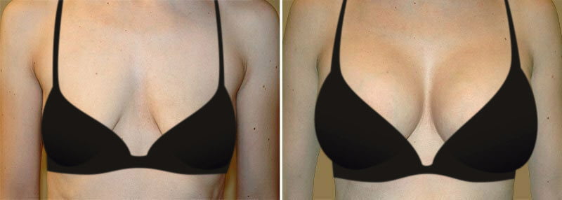 Brazilian breast Oil for sagging Breasts | Bust Tightening Shape & Size up Toning Massage Oil Quick Lifting Firming Breast Enhancement Oil