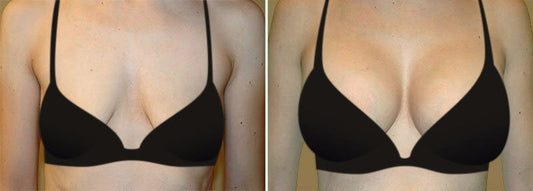 Brazilian breast Oil for sagging Breasts | Bust Tightening Shape & Size up Toning Massage Oil Quick Lifting Firming Breast Enhancement Oil